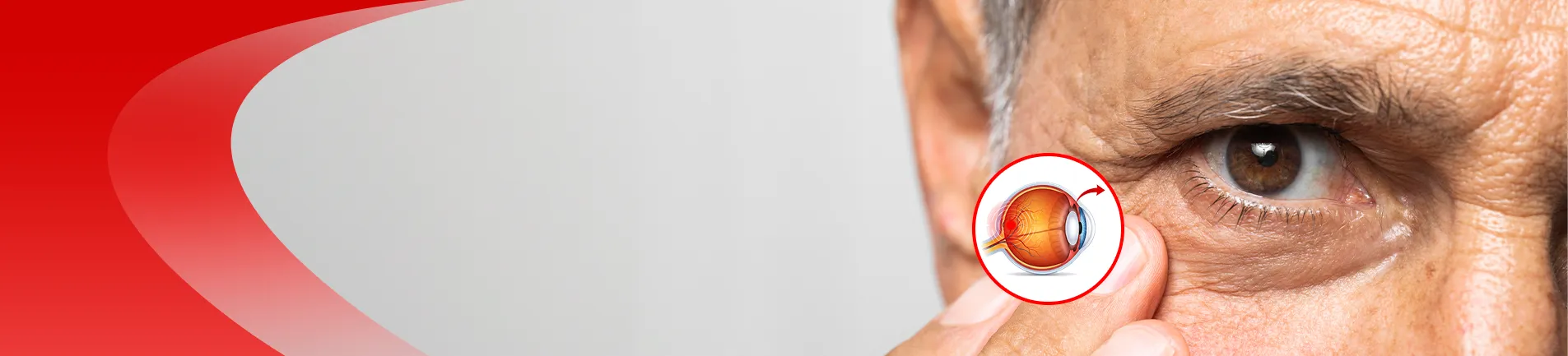 Diabetic Retinopathy Care Banner