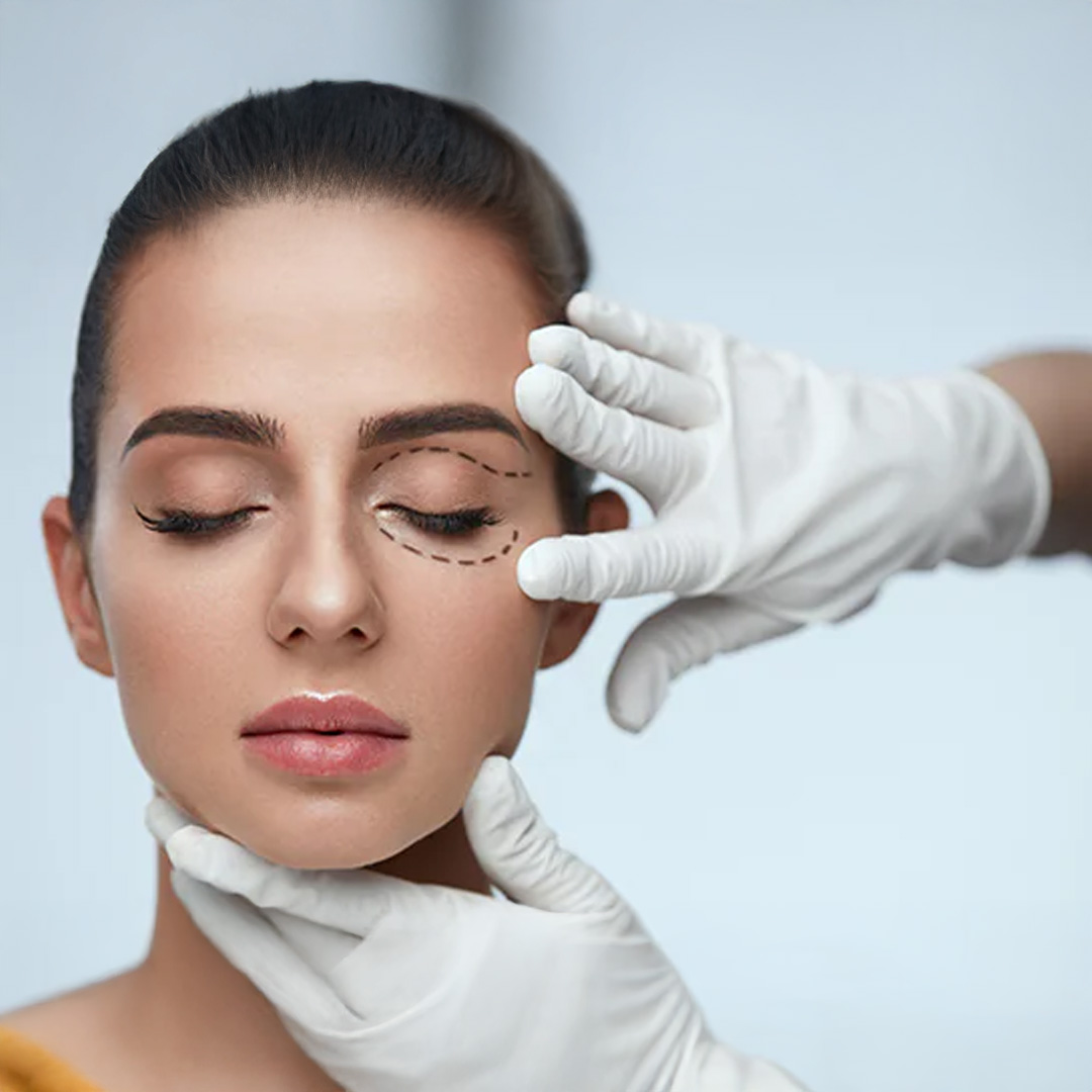 Oculoplasty Services
